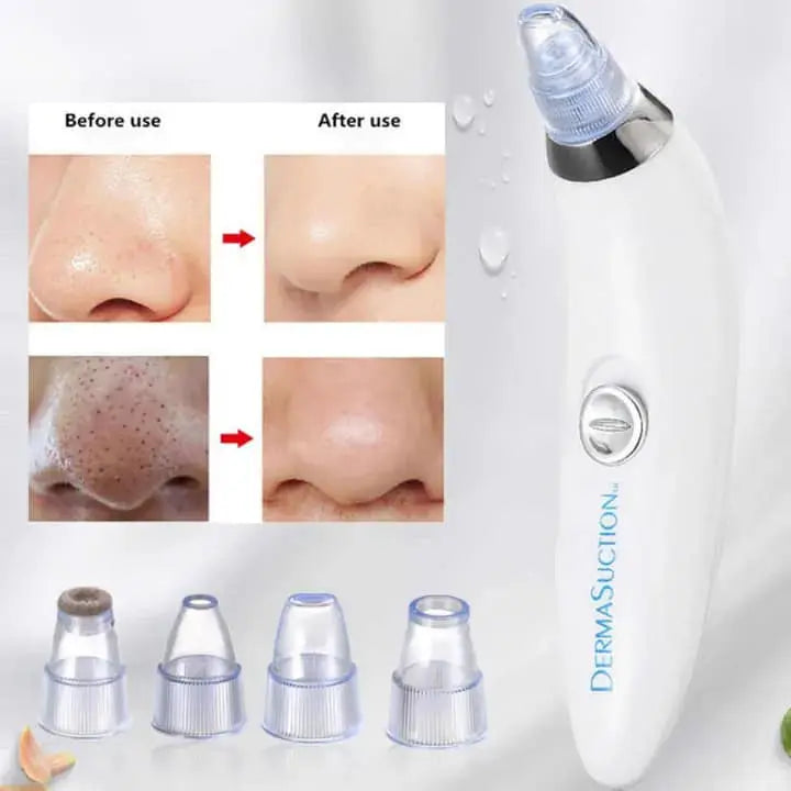 Derma suction Blackhead Remover Vacuum Acne Cleaner Black Spots Removal ShopsPk